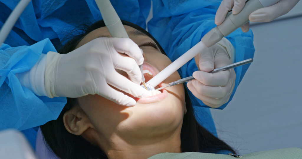 Town & County Dental Care root canals